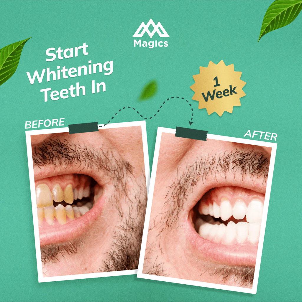 Magics PearlX Teeth Whitening Toothpaste