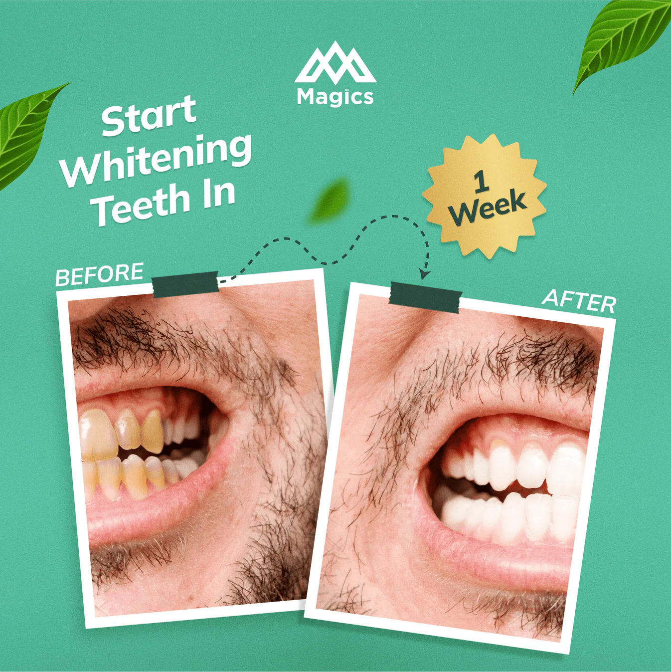 Magics PearlX Teeth Whitening Toothpaste