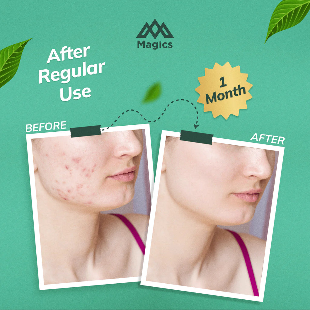 Magics Face Soap for Healthy & Glowing Skin