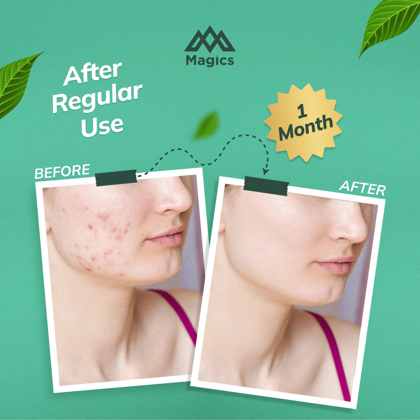 Magics Face Soap for Healthy & Glowing Skin