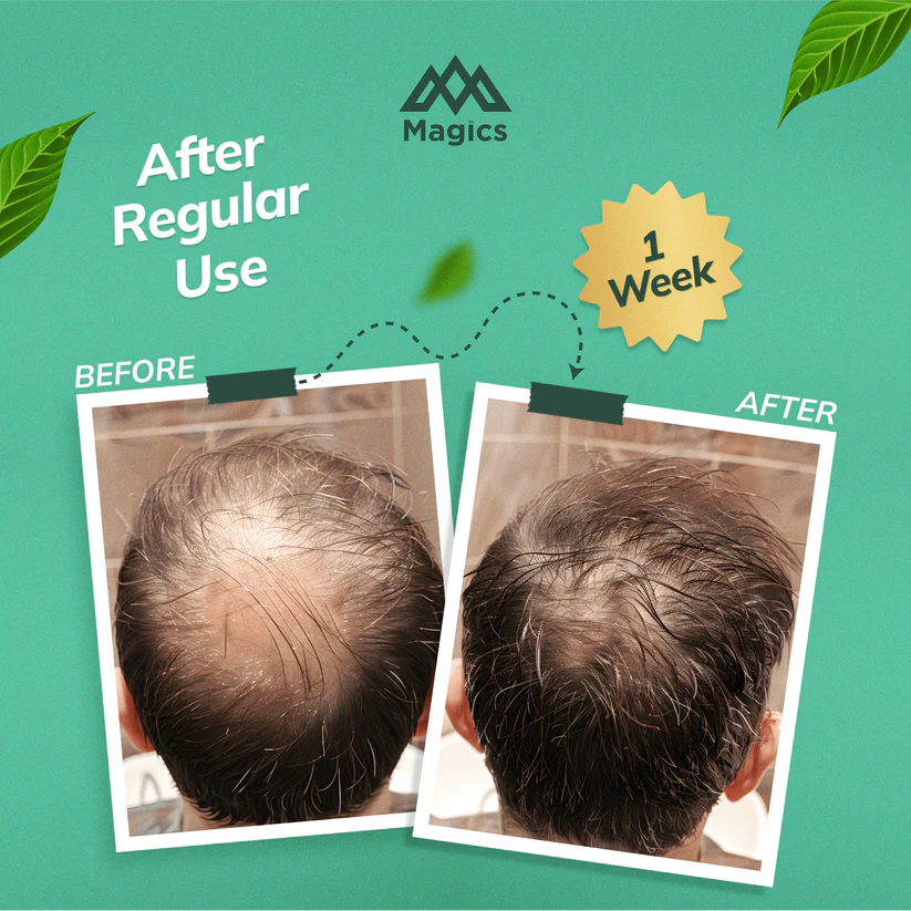 Magics Ayurvedic Shampoo Mix